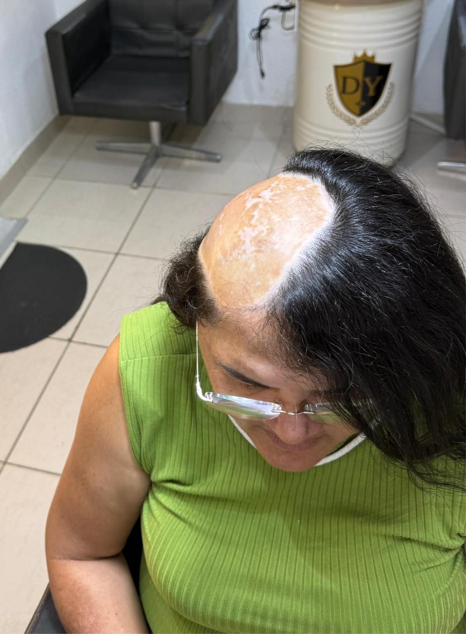 Transformação 3