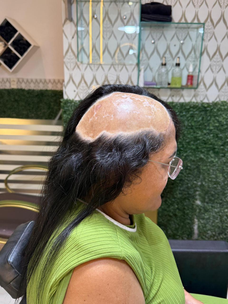 Transformação 4